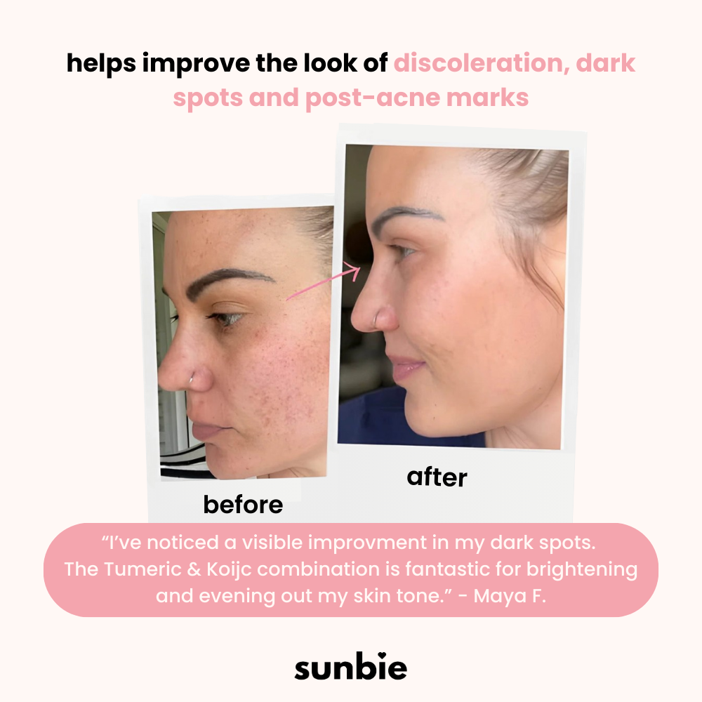Sunbie Turmeric Acid Pads