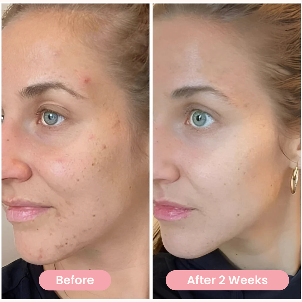 Sunbie Turmeric Acid Pads