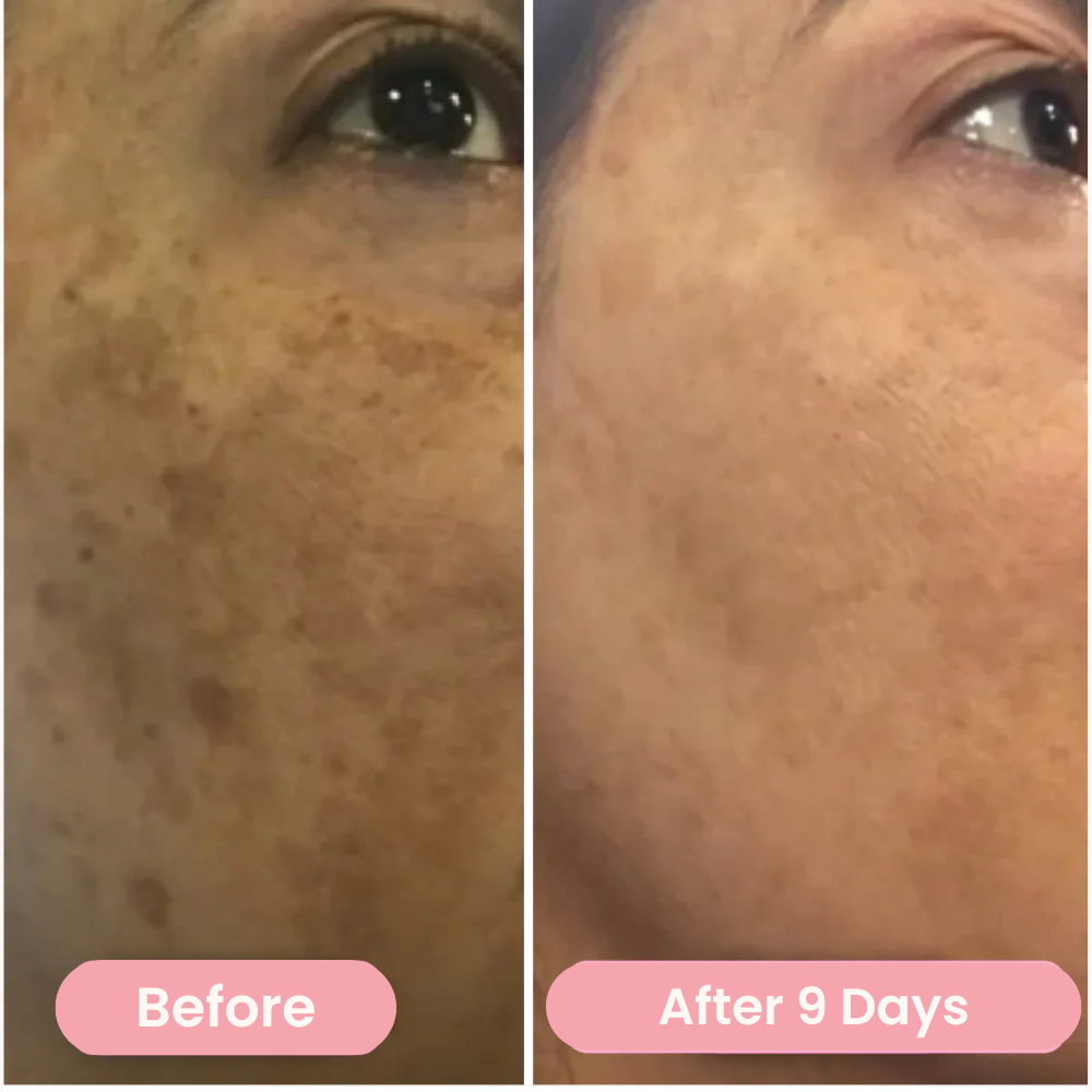 Sunbie Turmeric Acid Pads