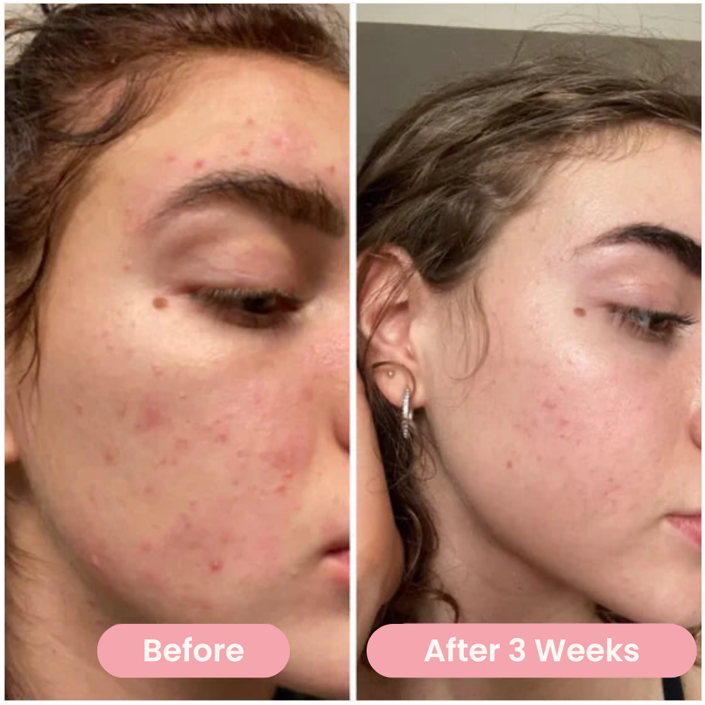 Sunbie Turmeric Acid Pads